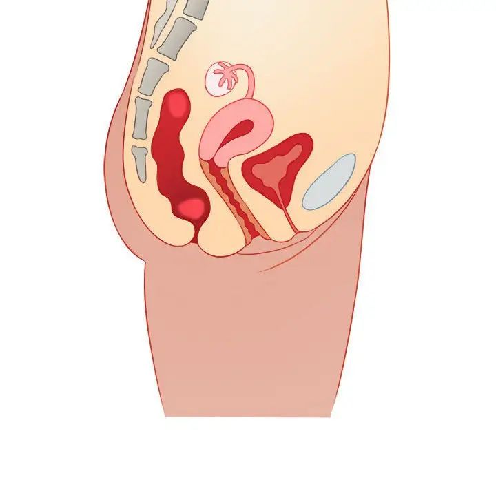 难缠小恶女第185话