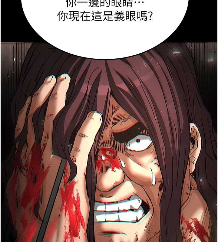 末日鵰堡第47話-這可是活生生移植的眼睛