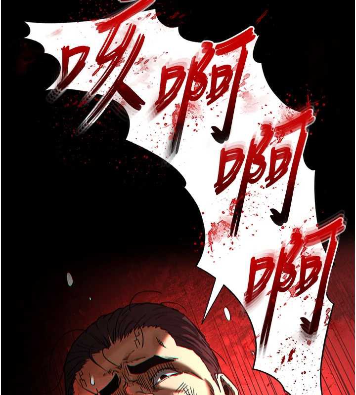 末日鵰堡第47話-這可是活生生移植的眼睛